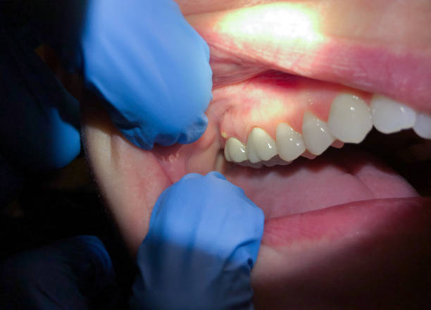 Best Orthodontic Emergency Dentist in Atlantic, IA
